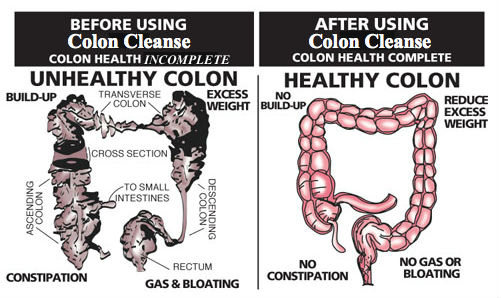 Colon Cleanse - Colon Before And After