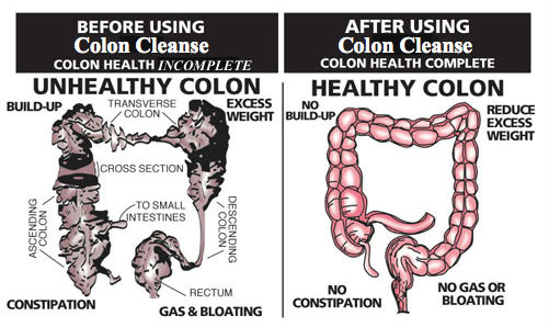 What Causes For Colon Cleanse To Be So Important Health And Love Page