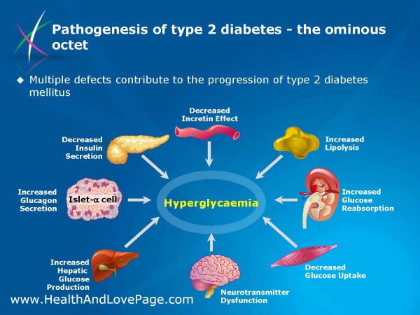 Type 2 Diabetes - Pathogenesis