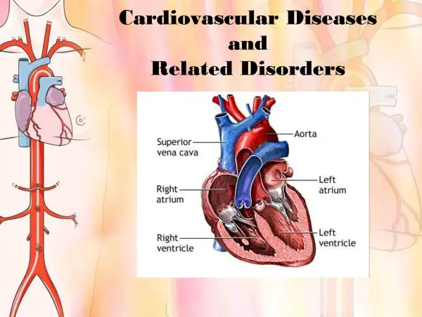 Cardiovascular Diseases - Heart DIsease