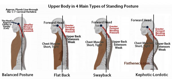 Neck Pain - Upper Body Postures