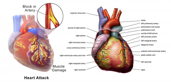 Heart Disease - Featured