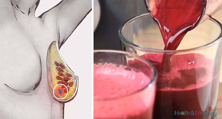 10 Reasons Why You Should Drink Beet Juice Every Day (5 Recipes Included)