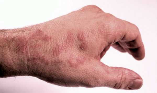 10 Unexpected Signs You Should Stop Eating Gluten Immediately – Health