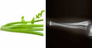 Foods That Look Like The Body Parts - Celery-Bones