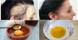 The Magic Recipe For Fastest Hair Growth! 3 Ingredients Only