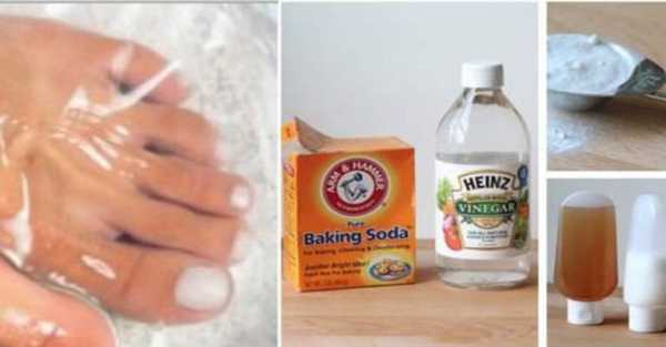 This Super Easy 2 Ingredient Way Will Get Rid Of Nail Fungus Forever