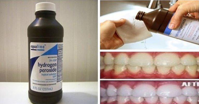 24 Incredible Uses of Hydrogen Peroxide