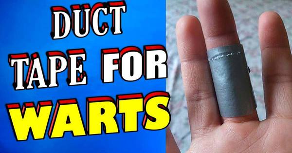 Duct Tape for Removing Warts – This Treatment is Backed by Science