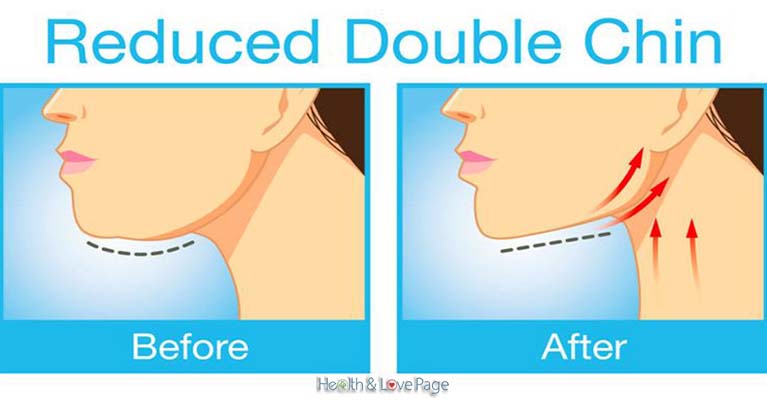 The Simple Solution to Get Rid of Unwanted Chin & Neck Fat Forever (VIDEO)