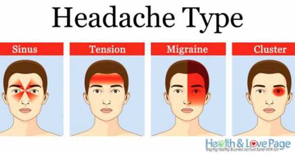 This Is How Headaches Reveal What is Wrong with Your Health (And How To ...