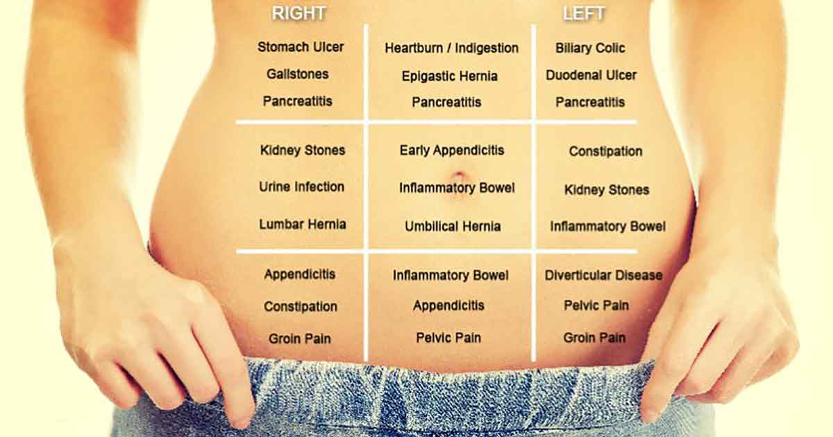 Abdomen Pain Map