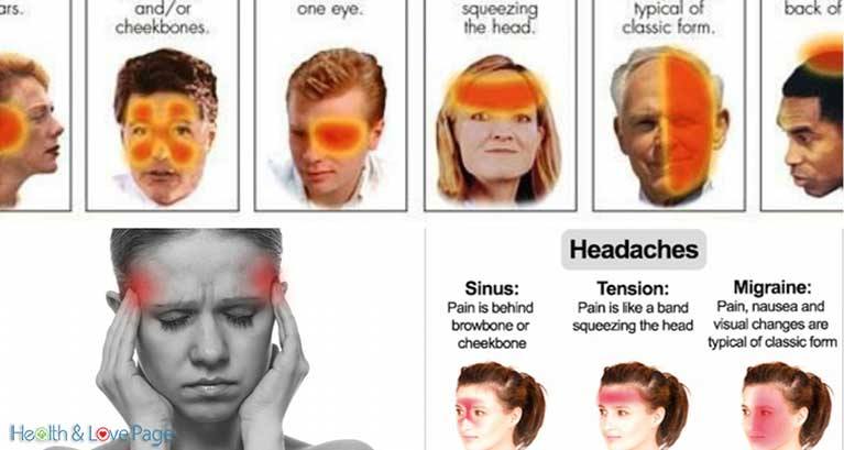 6 Different Types of Headaches (Signs and How to Recognize)