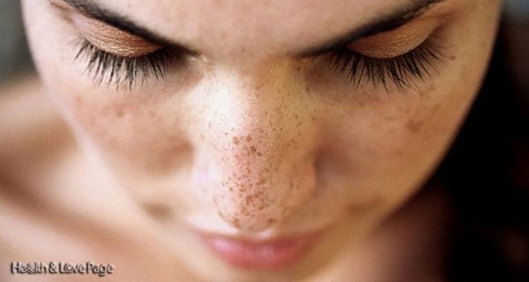 1-minute-recipe-to-remove-the-spots-on-your-face