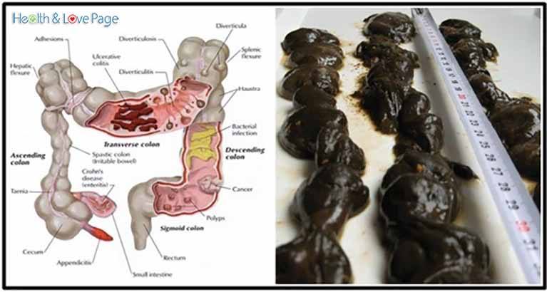 Flush Out Over 30 Toxic Pounds from Your Body Using Apple, Ginger and Lemon