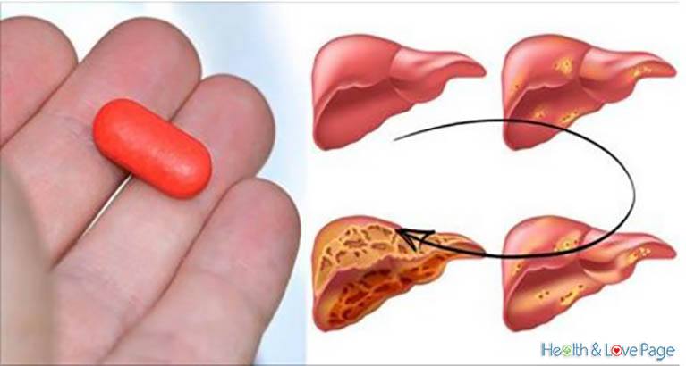 This Common Drug Destroys Your Liver