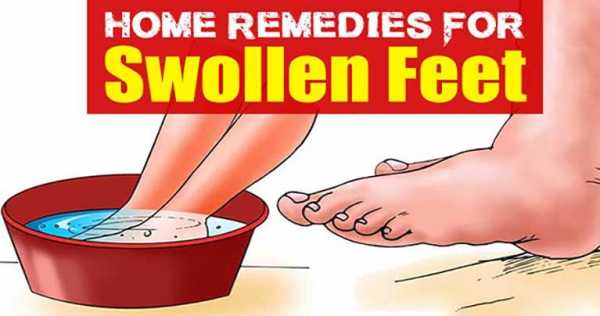 how-to-reduce-swelling-in-feet-and-ankles-health-and-love-page