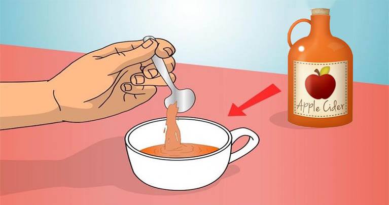 You Can Thank Us Later – 22 Ways to Use Apple Cider Vinegar as a Remedy