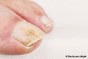 10 Pictures of What Your Nails Say about Your Health