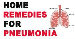 How to Speed Up the Recovery from Pneumonia and Avoid Further ...